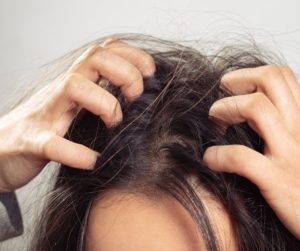 Person itching their head from head lice infestation